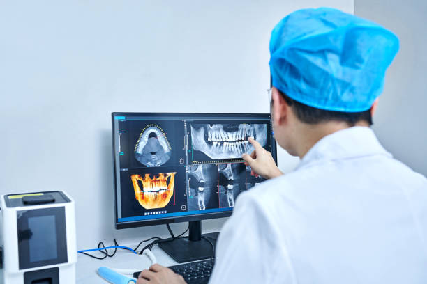 Best Emergency Dental Extractions in Burnsville, NC